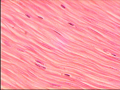 The type of tissue allows movement