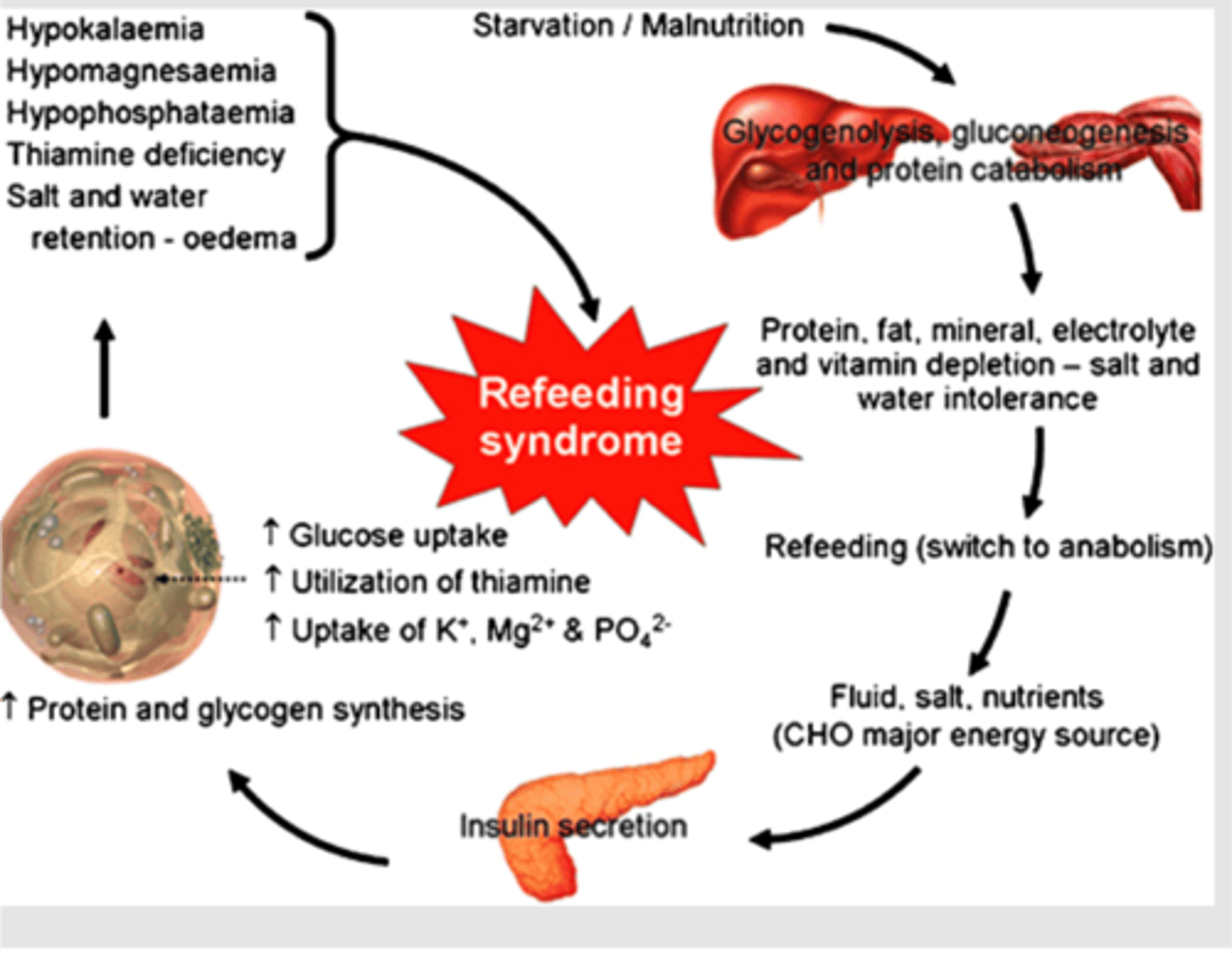 <p>starvation causes loss of PO4 from cells. when you refeed, theres a shift from fat to carbs [within 4 days of refeeding)</p><p>cells begin to take in PO4, K+, Mg2+</p><p>= hypophosphatemia, hypokalemia, hypomagnesaemia</p>