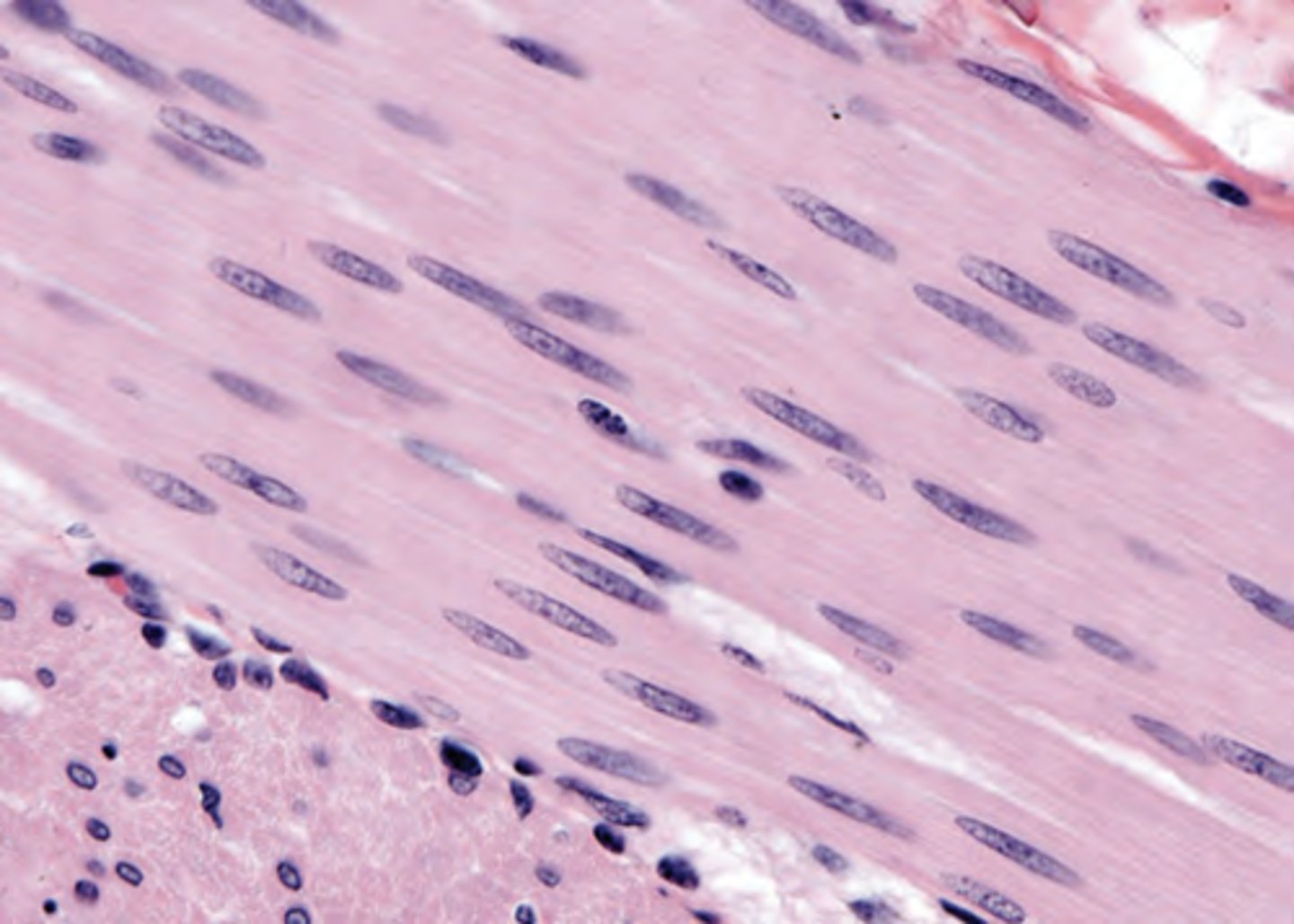 <p>The wall of the colon is examined at autopsy (shown in the image). Identify the tissue.</p><p>(A) Dense regular connective tissue</p><p>(B) Elastic connective tissue</p><p>(C) Nerve fibers</p><p>(D) Skeletal muscle</p><p>(E) Smooth muscle</p>