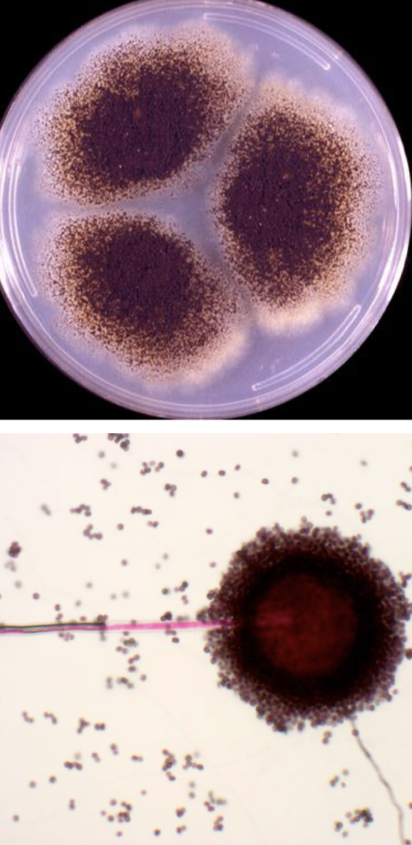 <p>Aspergillus niger</p>