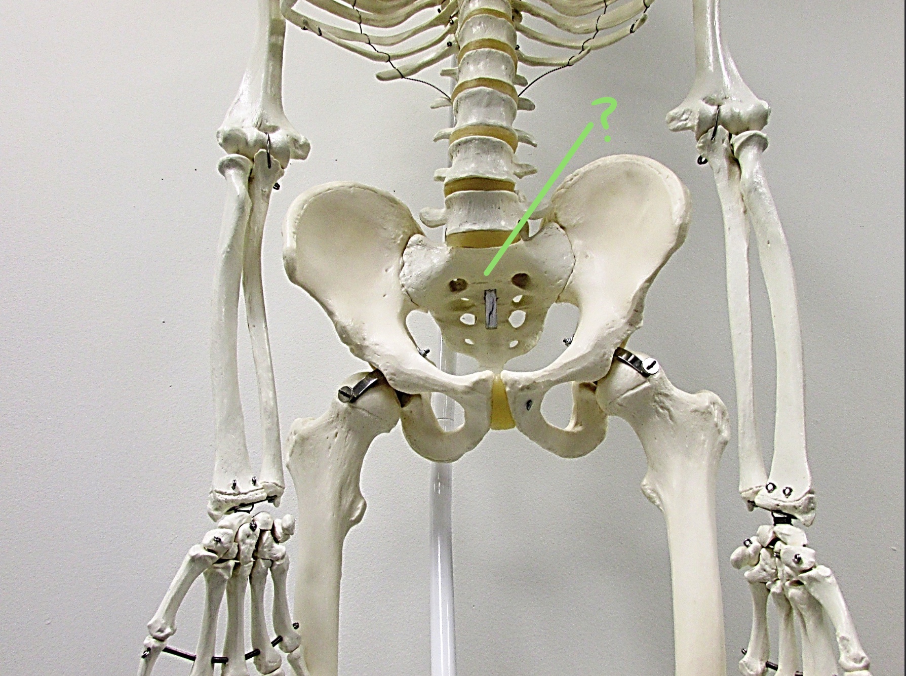 <p>Determine the part of the Coxa/Sacrum highlighted</p>