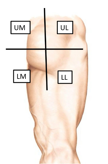 <p>What is the origin of the nerve providing sensory information to the lower lateral quadrant?</p>