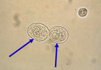 <ol start="46"><li><p>What does a squamous epithelial cell look like?</p></li></ol><p>where are they derived?</p>