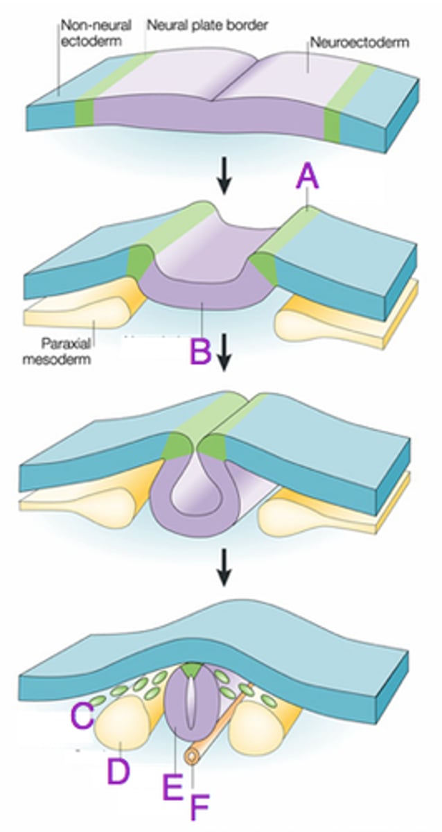 <p>(1) thickening of neuroectoderm (neural plate)</p><p>(2) invagination</p><p>(3) pinching off</p>