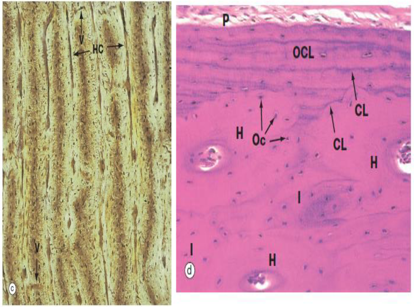 <ul><li><p>systeem van Havers: elementaire bouweenheid van corticale (compacte) bot</p><ul><li><p>kleine systemen van Havers kunnen ook op andere plaatsen dan het corticale bot voorkomen → bv. in dikkere balkjes van het trabeculair bot</p></li></ul></li><li><p>systemen van Havers → bij de mens duidelijkst ontwikkeld in diafyse van lange pijpbeenderen</p></li><li><p>aan periosteale &amp; endostale zijden:</p><ul><li><p>andere lamellensystemen evenwijdig aan botoppervlak → buitenste &amp; binnenste circumferentiële lamellen</p></li></ul></li><li><p>tussen osteonen liggende min of meer driehoekige tot veelhoekige gebieden = interstitiële lamellen</p><ul><li><p>zijn de resten van afgebroken osteonen</p></li></ul></li></ul><p></p>