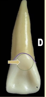 <p><mark data-color="blue" style="background-color: blue; color: inherit">maxillary central incisors #8 and #9; cingulum</mark></p>