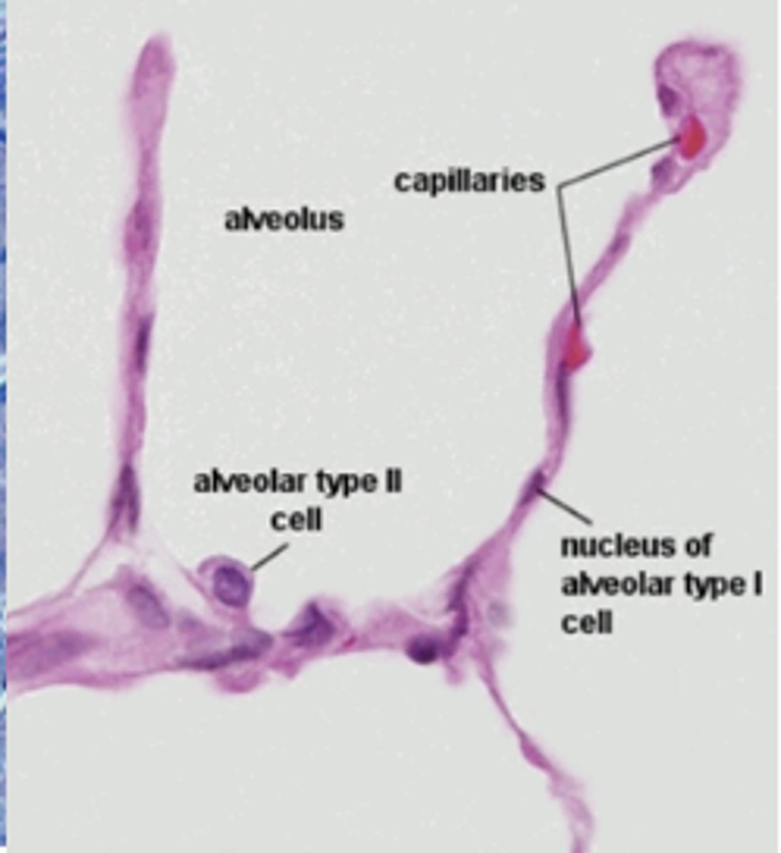<p>simple squamous epithelium</p>