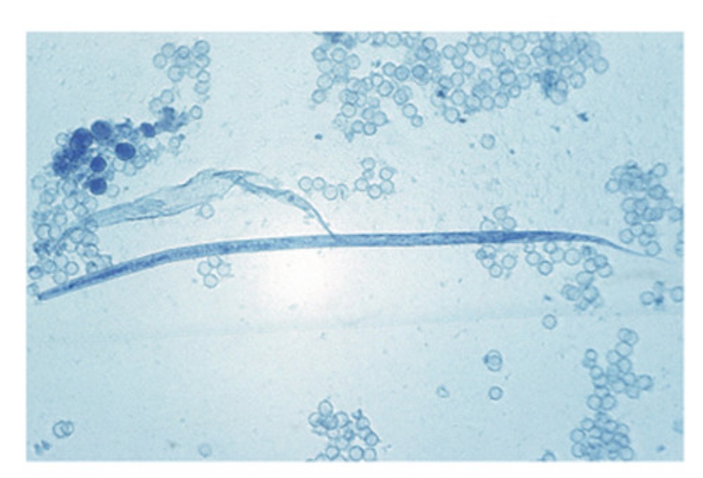 <p>The microfilariae of this nematode parasite is spread from dog to dog by the inermediate host, the __</p>