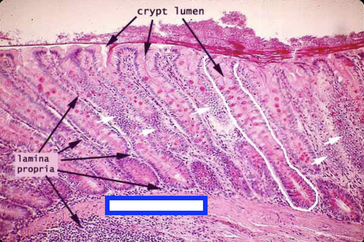 <p><span style="font-size: medium">a thin layer of </span>smooth muscle<span style="font-size: medium"> at the boundary between </span>mucosa<span style="font-size: medium"> and </span>submucosa</p>