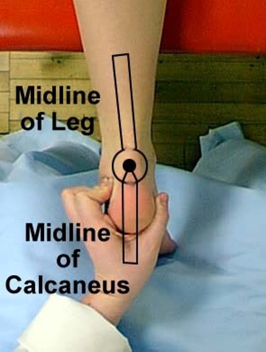 <p>fulcrum: posterior aspect of ankle halfway between malleoli<br>proximal: posterior midline shank<br>distal: posterior midline calcaneus<br><br>* PRONE<br>* move CALCANEUS<br>* normal = 5-12</p>