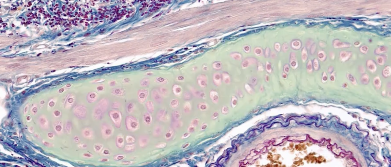 <p>What does the highlighted green part of cartilage represent?</p>
