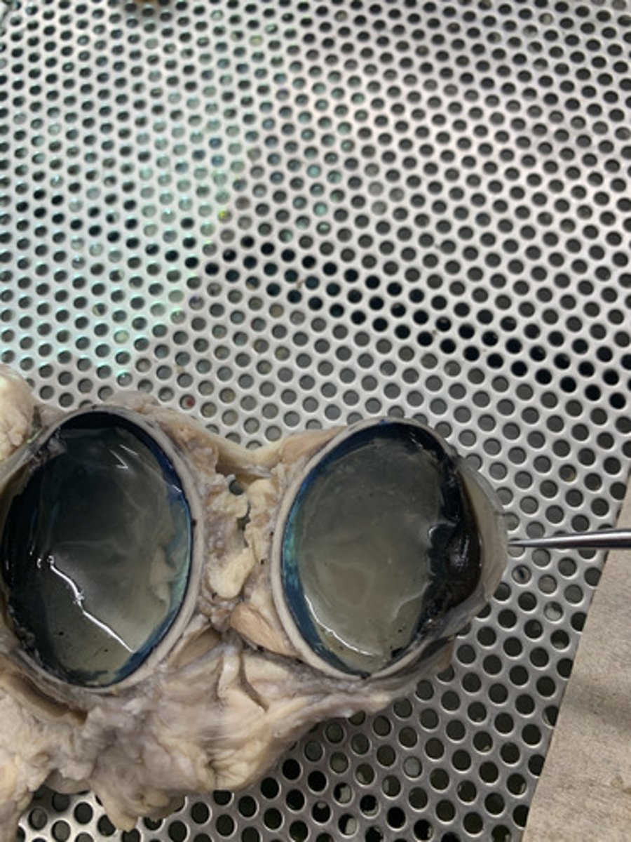 <p>The clear tissue of the fibrous tunic that covers the front of the eye</p>