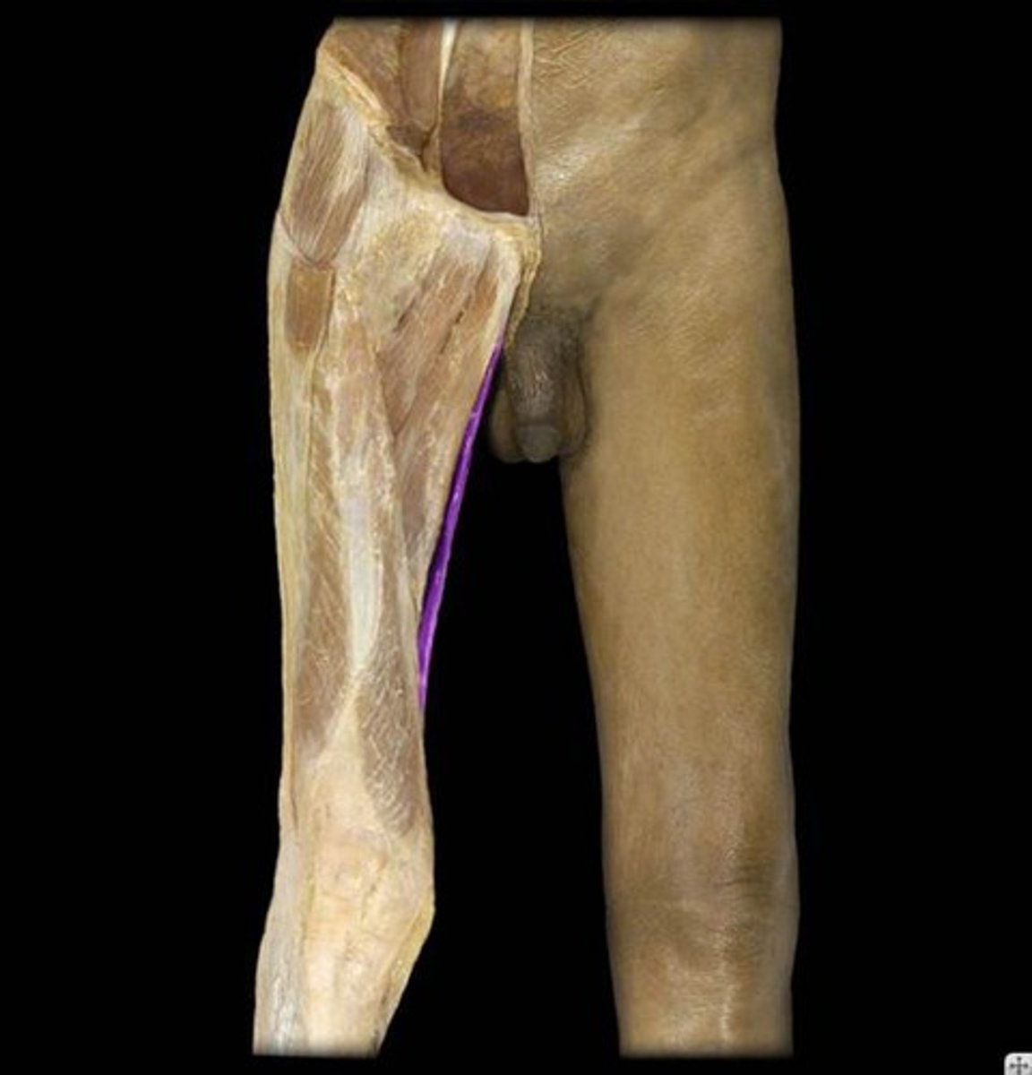 <p>What is the name of this muscle, highlighted in purple?</p>