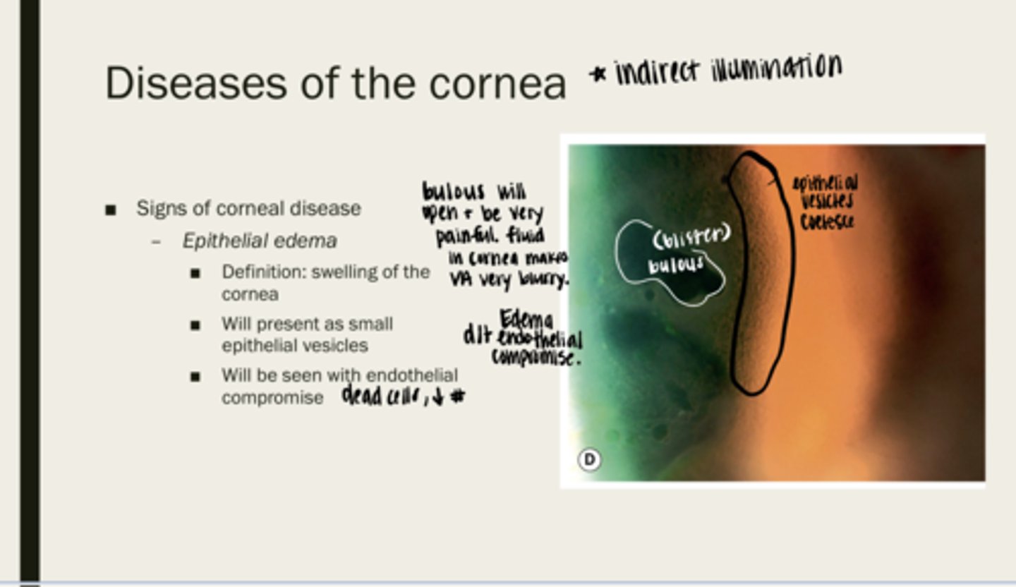<p>Are the bullous (blisters) that are caused by epithelial edema painful?</p>