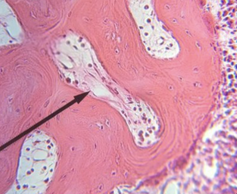 <p>what kind of bone is this </p>