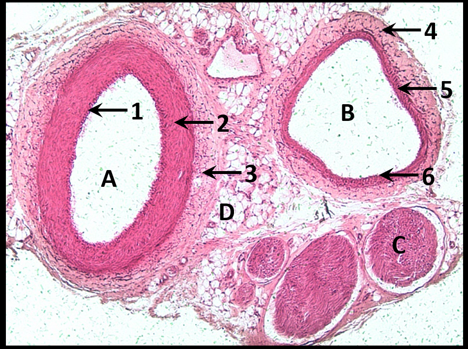 term image