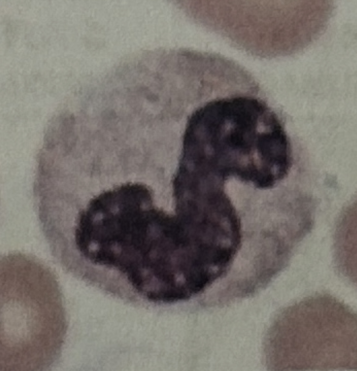 <p>WBC</p>