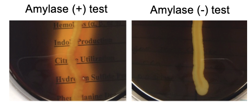 <p><span>– Areas of starch hydrolysis will appear clear. (+) Amylase test<br>– Unchanged starch will stain dark blue/black. (-) Amylase test</span></p>