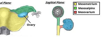<p>15. The normal ovary is found anterior to the broad ligament</p><p>A. Yes</p><p>B. No</p>