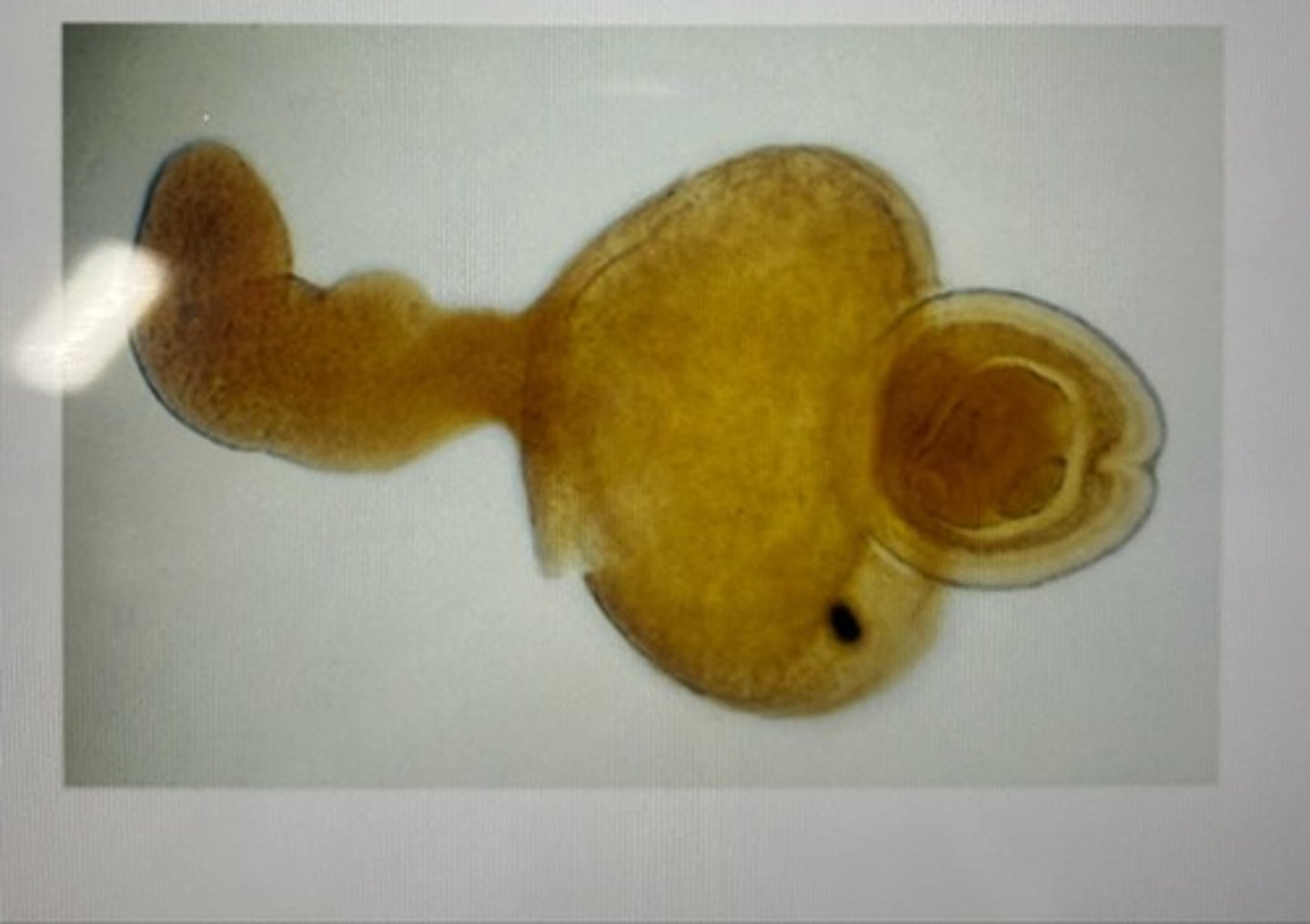 <p>This larval metacestode stage of a possible Cestode life cycle is microscopic with a small,</p><p>fluid-filled space. This type of larval Cestode stage is called the ____________, and commonly seen in arthropod intermediate hosts</p>