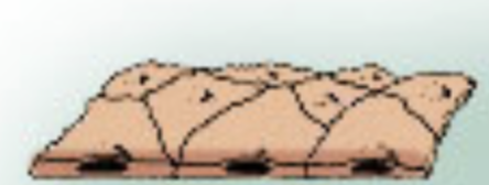 Which epithelial tissue is this by cell shape?