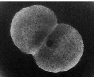 <p>-gram negative intracellular diplococci</p><p>-fastidious organisms requiring complex media and CO2-enriched atmosphere for optimal growth</p><p>-oxidase positive</p><p>-ferments glucose only v. N. meningitidis which ferments glucose and maltose</p><p>-infects mucus-secreting epithelial cells and evades host response through alteration of surface structures</p><p>-peak incidence 20-24 years of age</p>