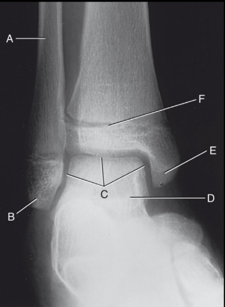 <p>D is:</p>