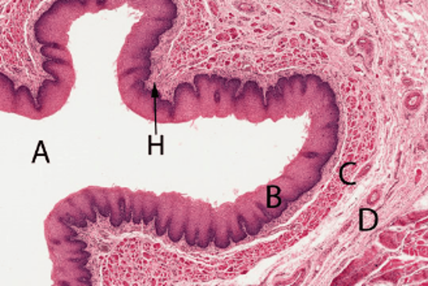 <p>Submucosa</p>