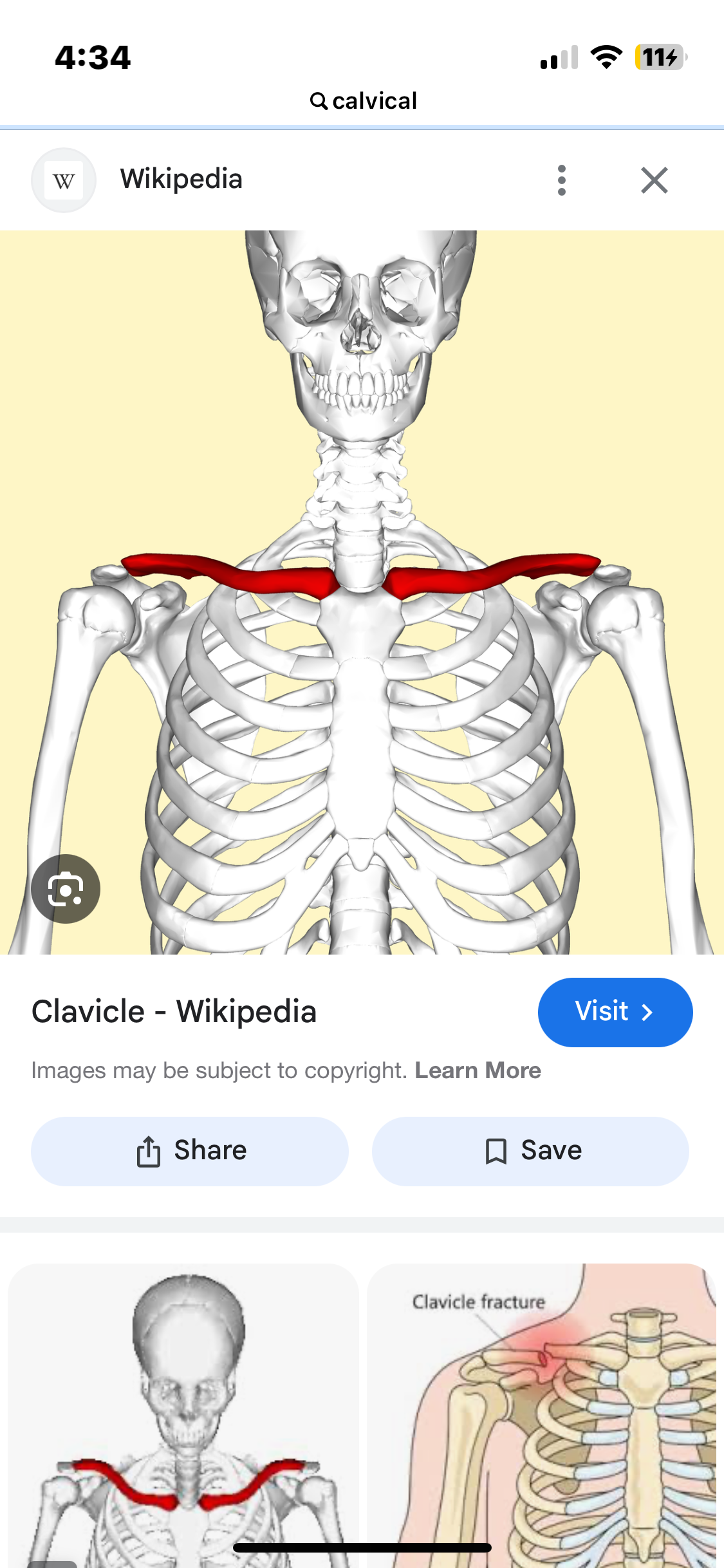 <p>• long bone ( runs medial - lateral) </p><p>• rounded sternal end ( articulates with sternum) </p><p>• Articulates with acromial process of scapula </p>