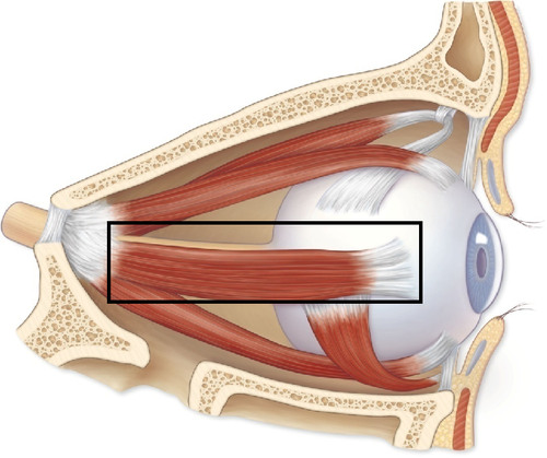<p>lateral rectus muscle</p>