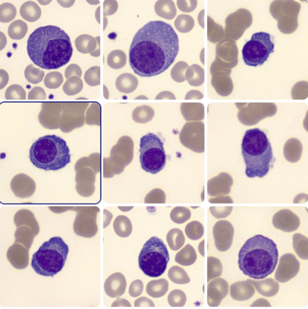 <p>- Round, ovoid eccentric nucleus</p><p>- Clumped chromatin, no nucleoli</p><p>- Abundant, deep-blue cytoplasm w/ clear area next to nucleus</p><p>- 1:2 N:C ratio</p>