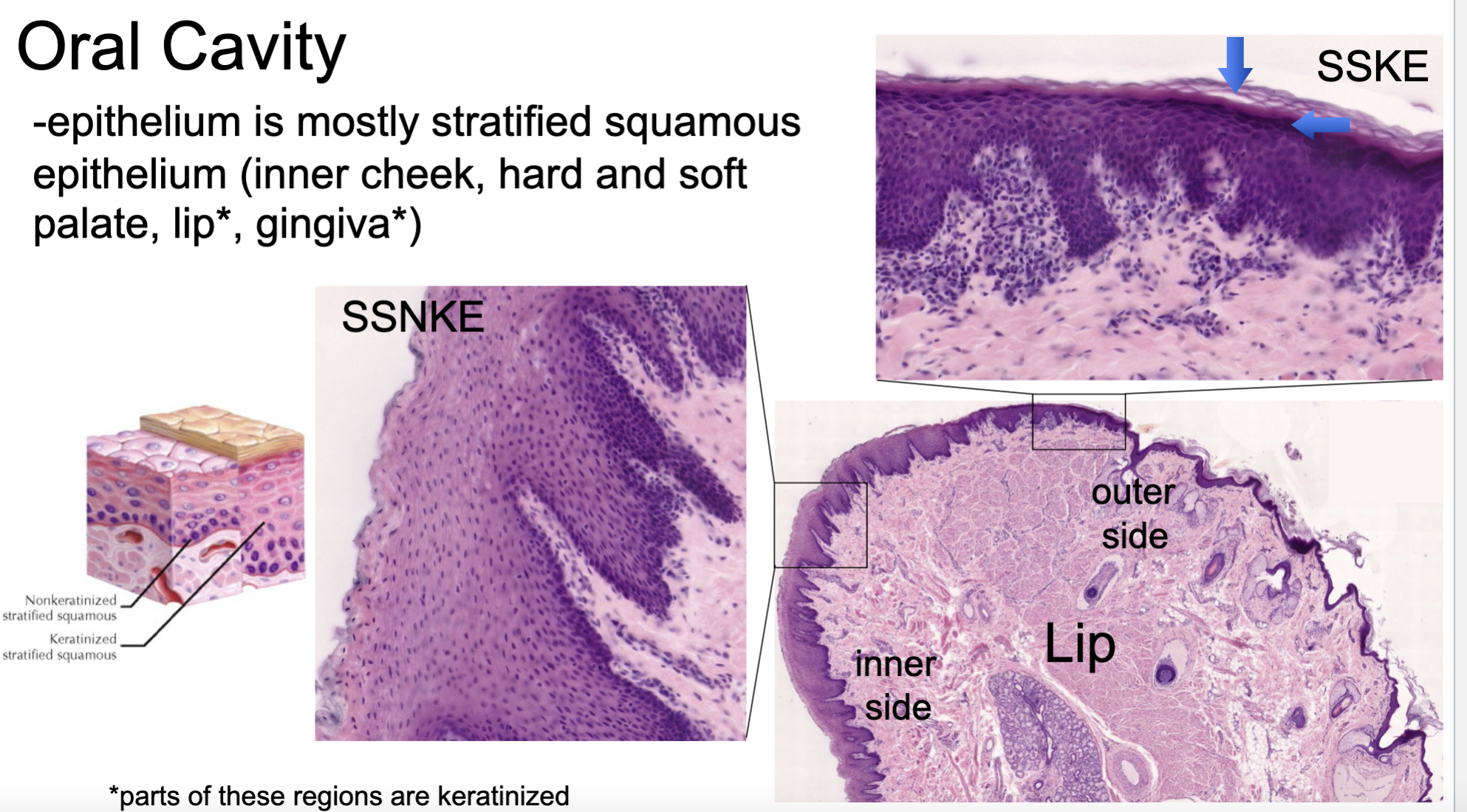 <p>mostly stratified squamous (inner cheek, hard and soft palate, <strong>lip</strong>, <strong>gingiva</strong>)</p>