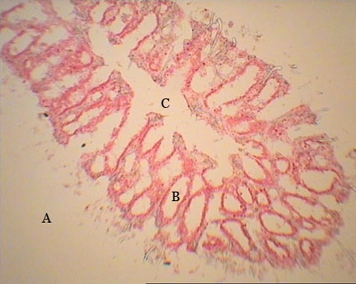 <p>-has a folded wall that forms incurrent canals opening to the outside and flagellated canals opening to the central spongocoel<br>-canals are lined with choanocytes<br>-specialized collar of microvilli surrounding flagellum of a choanocyte traps food particles that are engulfed by the cell body<br>-digestion is intracellular (occurs inside cells)</p>