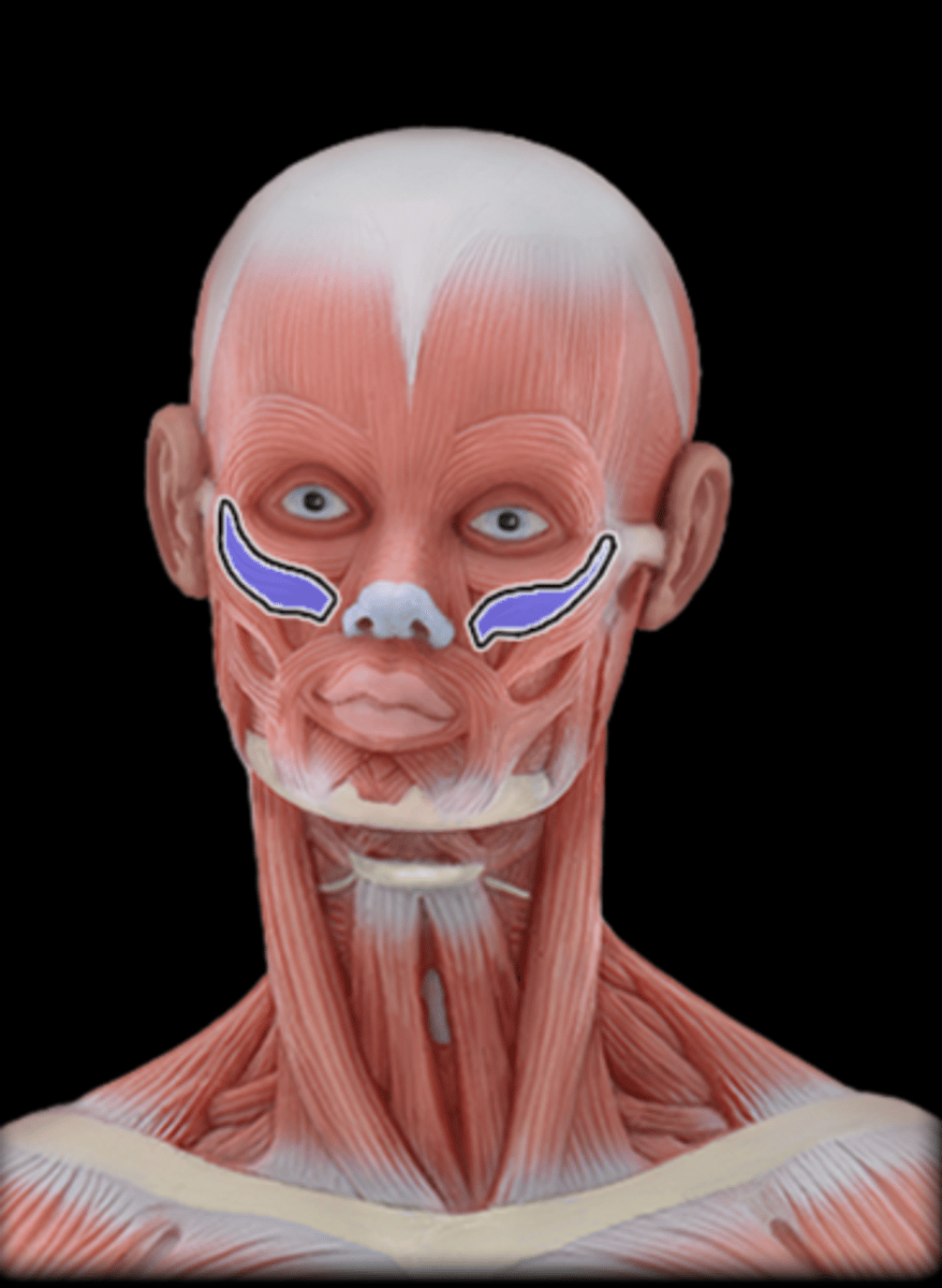 <p>What Muscle Is Highlighted?</p>