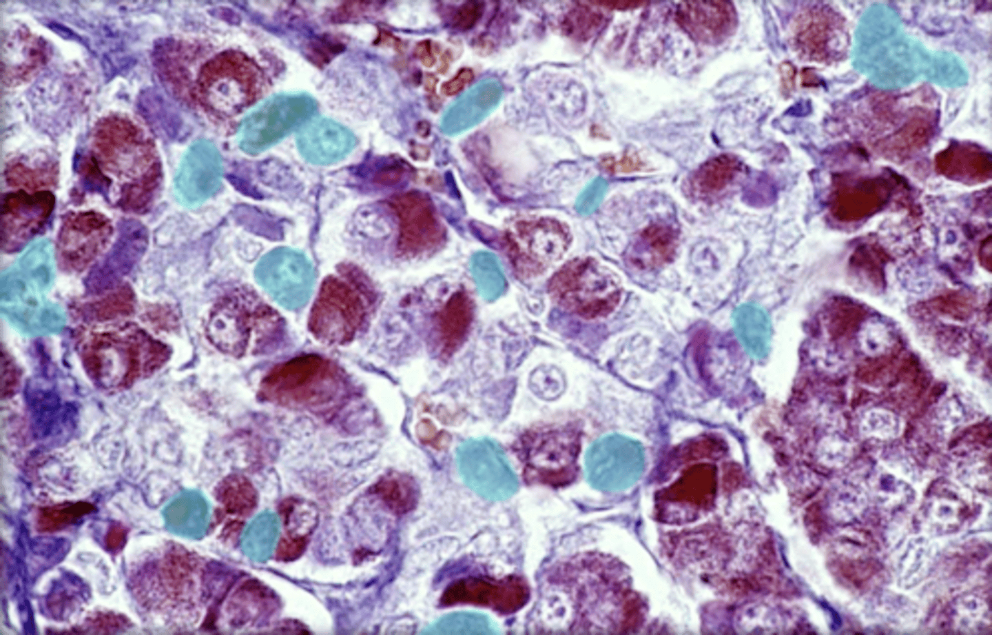 <p>granulated, respond to inflammation</p>