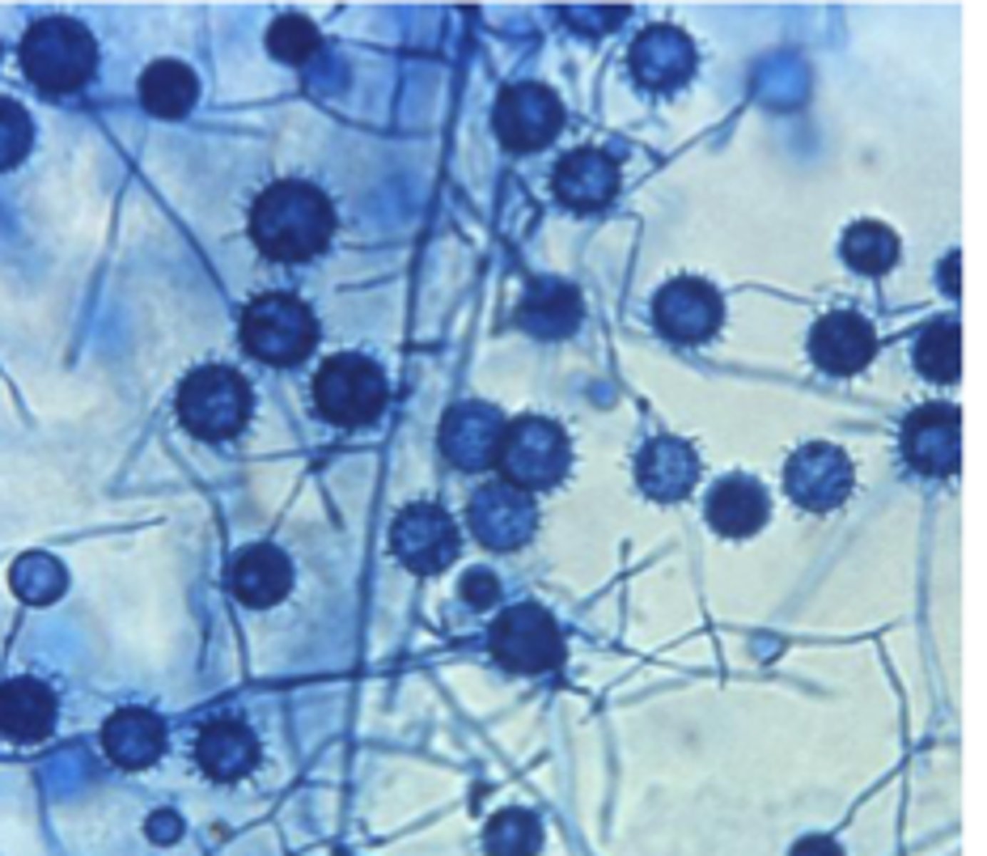 <p>A cat presents with weight loss, diarrhea, and anemia. Rectal scrape cytology shows numerous intracellular 2–4 µm yeast with narrow-based budding.Culture at 25°C shows septate hyphae with tuberculate macroconidia.</p><p>Photomicrographs of LPCB-stained _________________ prepared from colonies grown at 200C and</p><p>350C.</p>