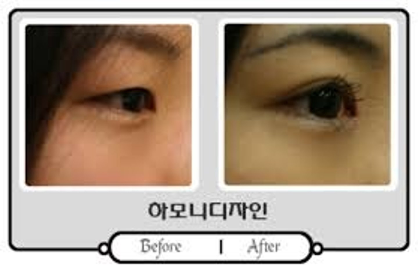 <p>mắt 2 mí/ 1 mí</p>