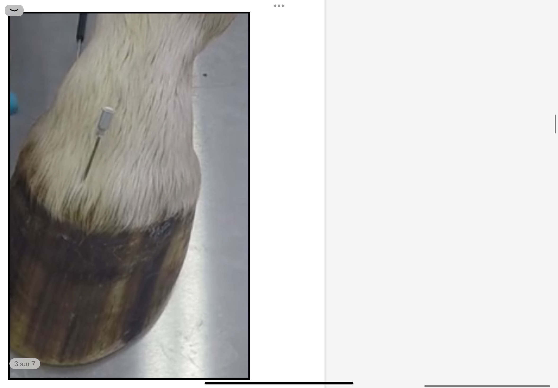 <p>Ponction dans le récessus DORSAL</p><p>Repères pour la ponction: On pique à travers le tendon de l’extenseur commun/ long en diagonale. os</p>