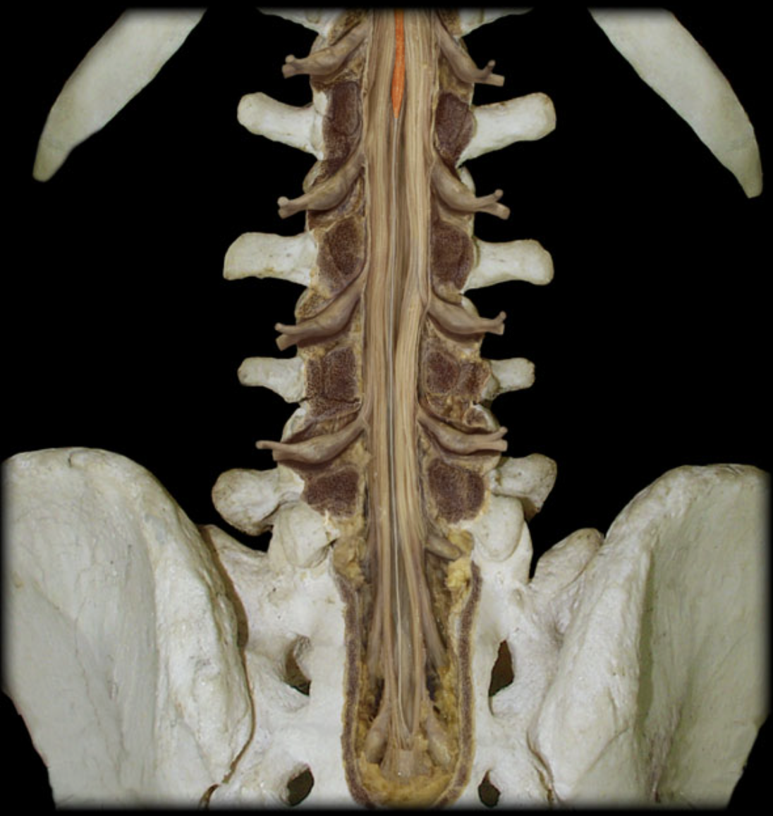 <p>What is the highlighted structure? (orange)</p>