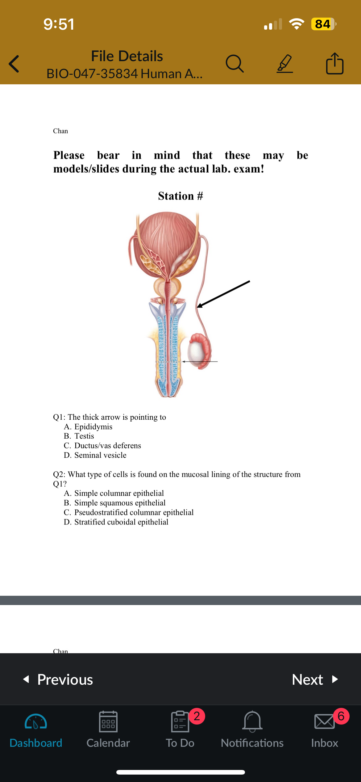 <p>Q1: The thick arrow is pointing to?</p>