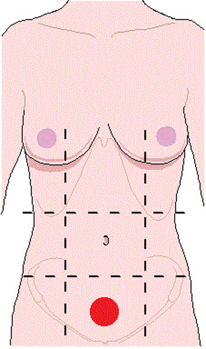 <p>located in the lower middle section of the abdomen beneath the umbilical region</p>