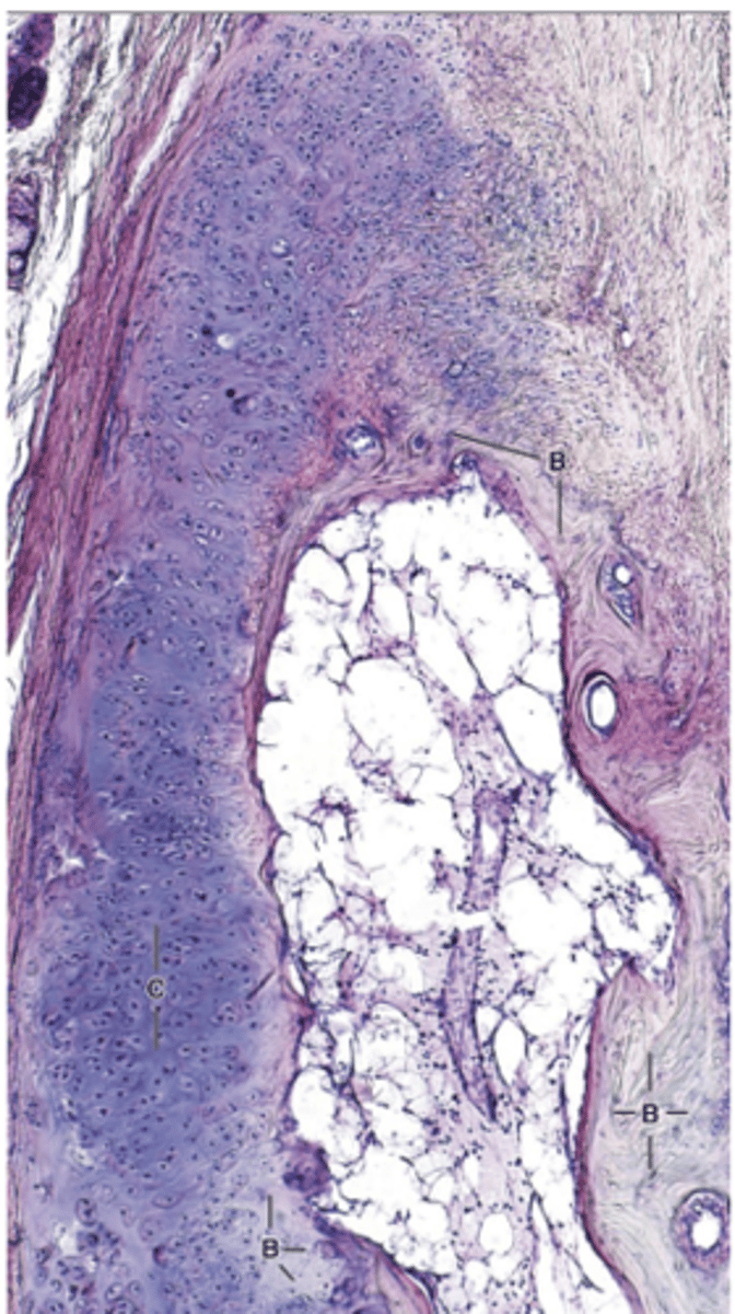<p>How long does cartilage calcification take?</p>
