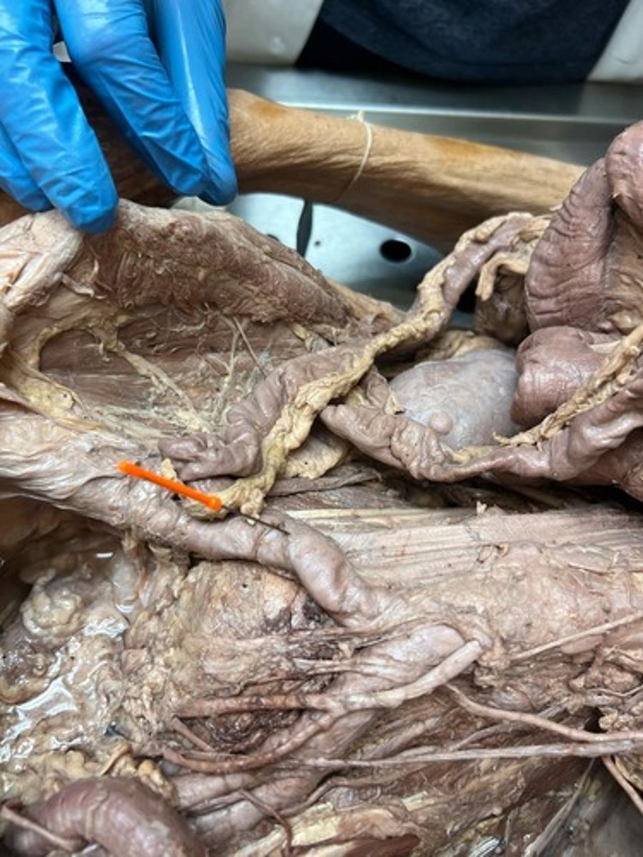 <p>common iliac artery l-p</p>