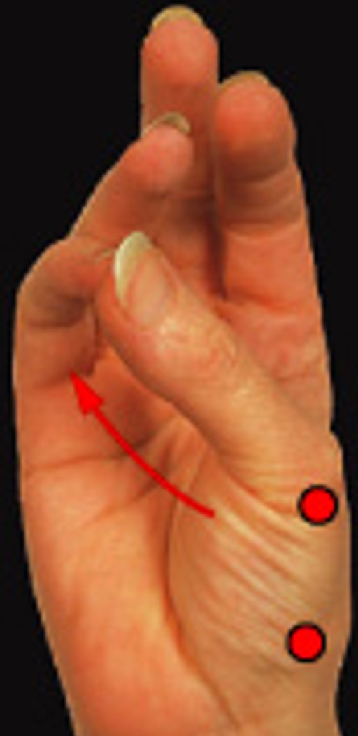 <p>Which special movement is:</p><ul><li><p>Thumb movement toward little finger</p></li></ul><p></p>