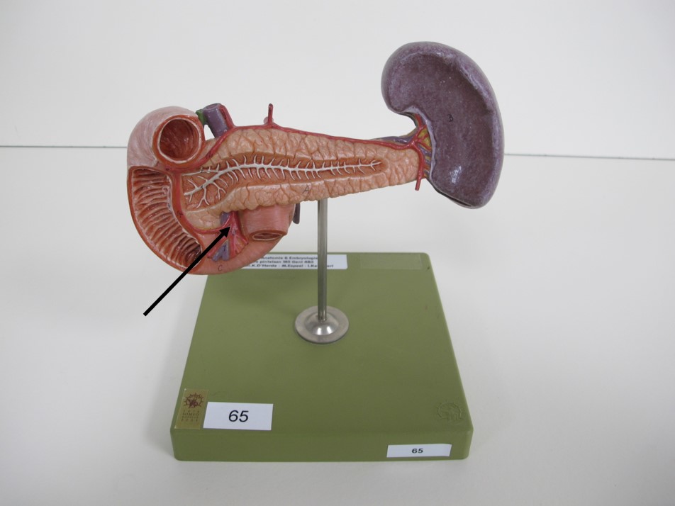 <p>arterie die verschijnt tussen pancreas en duodenum</p>