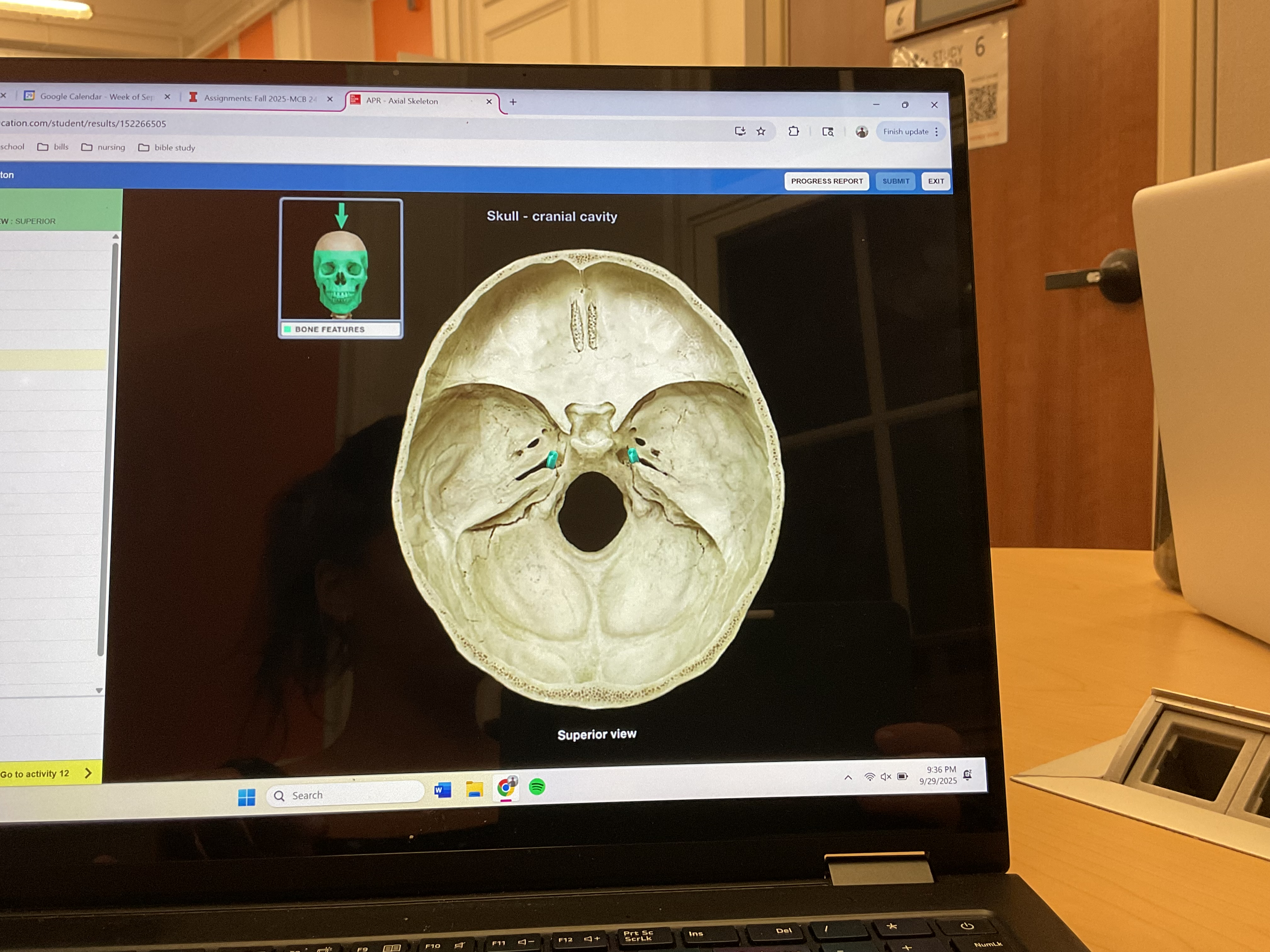 <p>Foramen lacerum</p>