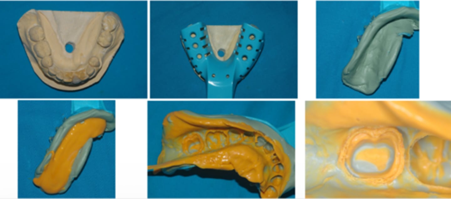 <p>What technique is shown?</p><p>- Tray Material — Heavy to Putty Viscosity</p><p>- Require Spacer or some sort of space relief or by grinding the tray material after it set</p><p>- Syringe Material — Low viscosity</p>