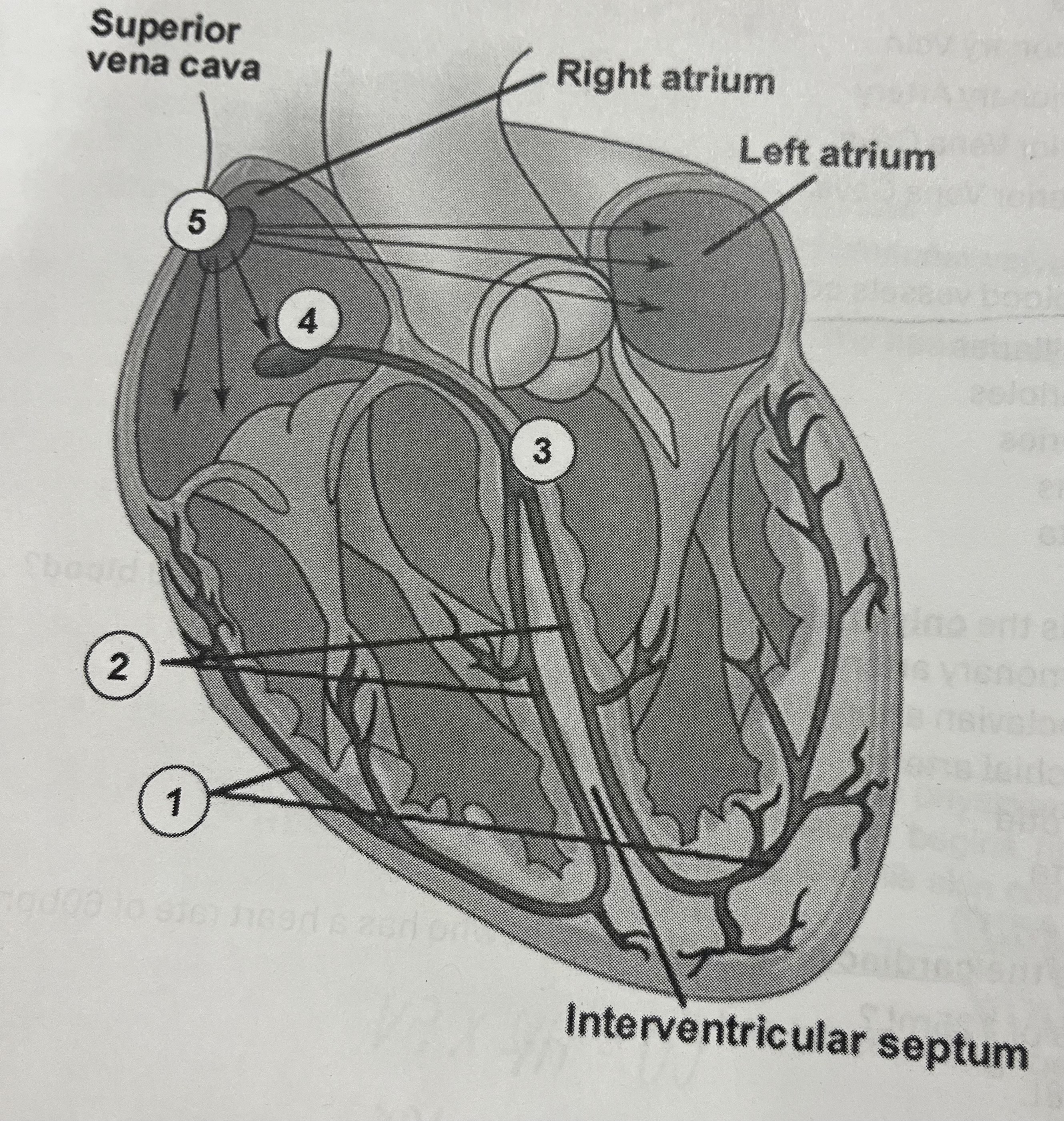 <p>Which site acts as the pacemaker of the heart?</p>