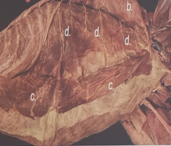 <p>Identify the structure labelled D.</p>