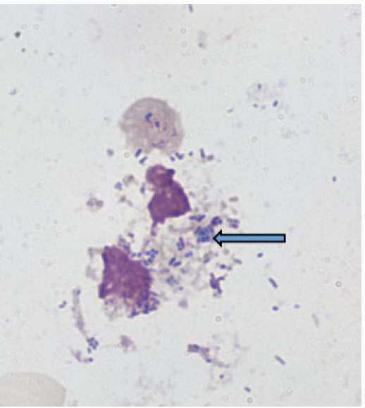 Wright’s or Giemsa stain on smear from lesion

Appearance of Donovan bodies (clusters of blue/black stained organisms in cytoplasm of mononuclear cells)